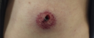 spari